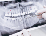 歯並び、矯正治療